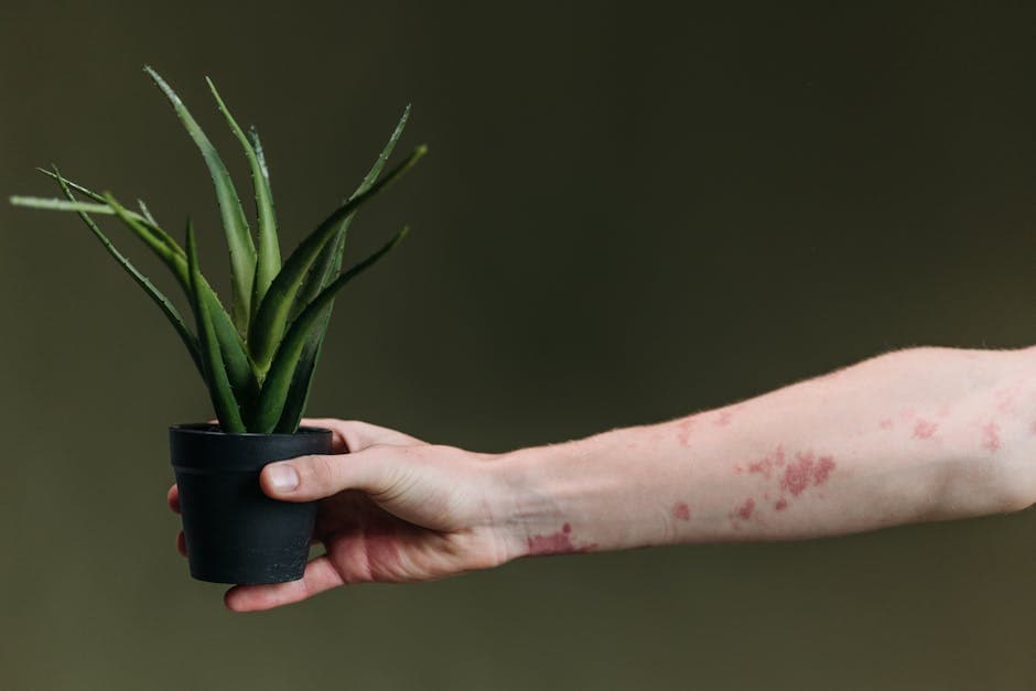 Soulager un coup de soleil naturellement [Naturel] — astuce santé BonneAstuce.fr